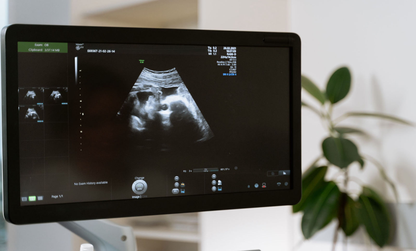 image-ultrasound-promo
